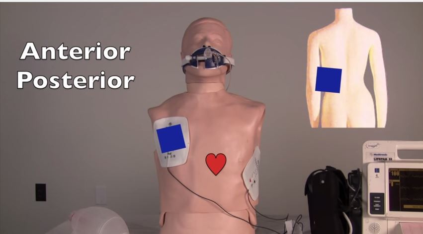 Defibrillator & Paddle Usage